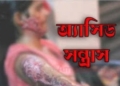 ফিরে এলো অতীত বর্বরতা; ধর্ষণে সাক্ষী হওয়া নারীর মাকে এসিড নিক্ষেপ